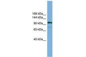 Image no. 1 for anti-HIR Histone Cell Cycle Regulation Defective Homolog A (HIRA) (AA 601-650) antibody (ABIN6744564) (HIRA Antikörper  (AA 601-650))