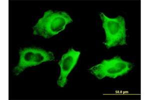 Immunofluorescence of monoclonal antibody to MYH9 on HeLa cell.