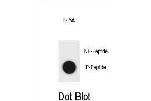 Dot blot analysis of Mouse CCNB2 Antibody (Phospho ) Phospho-specific Pab (ABIN1881161 and ABIN2839965) on nitrocellulose membrane.