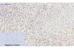 Immunohistochemical analysis of paraffin-embedded human uterus tissue. (SYN1 Antikörper)