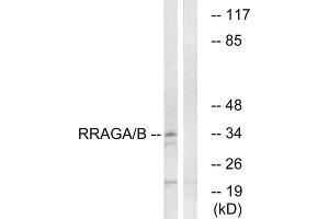 Western blot analysis of extracts from HepG2 cells, using RRAGA/B antibody. (RRAGA/B Antikörper  (C-Term))