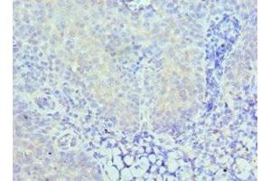 Immunohistochemistry of paraffin-embedded human tonsil tissue using ABIN7146923 at dilution of 1:100 (CARD8 Antikörper  (AA 1-200))