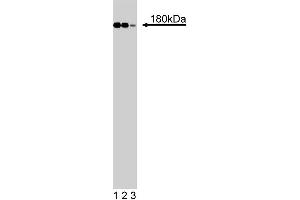 Western blot analysis of IRS-1 on RSV-3T3 cell lysate. (IRS1 Antikörper  (AA 1131-1234))