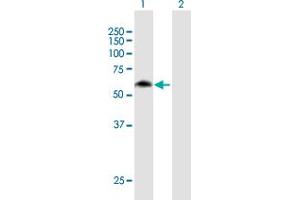 Western Blot analysis of MON1B expression in transfected 293T cell line by MON1B MaxPab polyclonal antibody. (MON1B Antikörper  (AA 1-547))