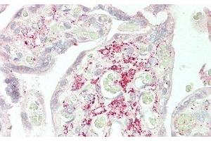 Detection of Slit2 in Human Placenta Tissue using Polyclonal Antibody to Slit Homolog 2 (Slit2) (SLIT2 Antikörper  (AA 1160-1333))