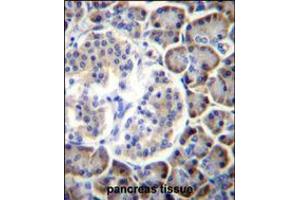 SMAP2 Antibody immunohistochemistry analysis in formalin fixed and paraffin embedded human pancreas tissue followed by peroxidase conjugation of the secondary antibody and DAB staining. (SMAP2 Antikörper  (AA 111-140))