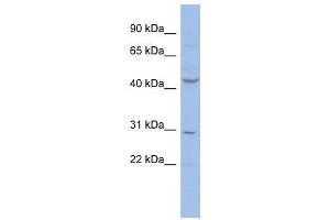 CCNE2 antibody (70R-10486) used at 0. (Cyclin E2 Antikörper  (N-Term))