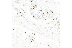 Immunohistochemistry analysis of paraffin-embedded rat skinusing Chymase (ABIN7073506) at dilution of 1:1000 (CMA1 Antikörper)