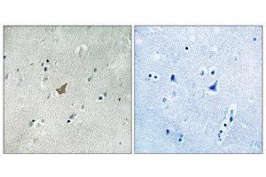 Immunohistochemistry (IHC) image for anti-EPH Receptor A3 (EPHA3) (pTyr779), (pTyr833) antibody (ABIN1847592) (EPH Receptor A3 Antikörper  (pTyr779, pTyr833))