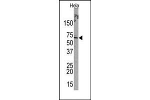 Image no. 1 for anti-Promyelocytic Leukemia (PML) (Sumoylation Site) antibody (ABIN357734) (PML Antikörper  (Sumoylation Site))