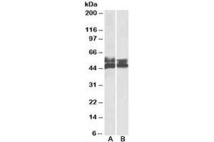 Western blot testing of human tonsil [A] and thymus [B] lysates with FCRL1 antibody at 0. (FCRL1 Antikörper)