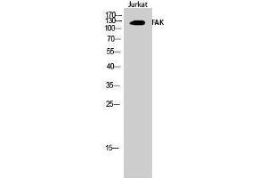 Western Blotting (WB) image for anti-PTK2 Protein tyrosine Kinase 2 (PTK2) (Thr446) antibody (ABIN3184583) (FAK Antikörper  (Thr446))