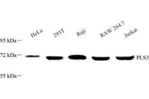 Western blot analysis of PLS3 (ABIN7075097) at dilution of 1: 500 (Plastin 3 Antikörper)