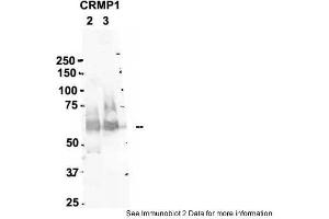 Sample Type: 2. (CRMP1 Antikörper  (N-Term))