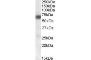 ABIN334360 (0. (BIN1 Antikörper  (Internal Region))