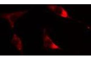 ABIN6275600 staining Hela cells by IF/ICC.