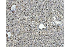 IHC analysis of ARG1 using anti-ARG1 antibody (ABIN6719532).