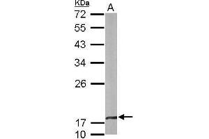 WB Image Sample (50 ug of whole cell lysate) A: mouse brain 12% SDS PAGE antibody diluted at 1:1000 (CRYbA4 Antikörper)