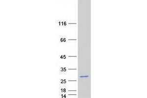 Validation with Western Blot