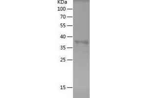 Western Blotting (WB) image for Cadherin 2 (CDH2) (AA 773-906) protein (His-IF2DI Tag) (ABIN7122074) (N-Cadherin Protein (AA 773-906) (His-IF2DI Tag))