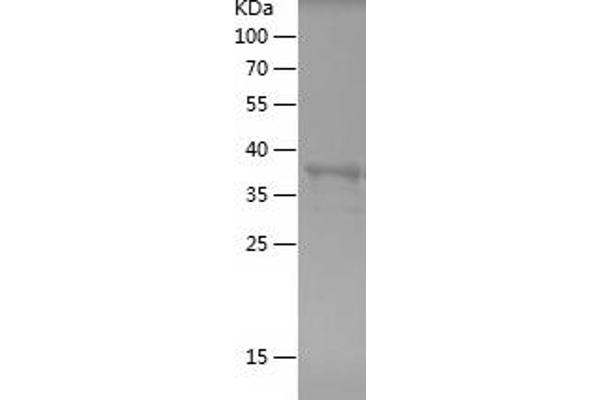 N-Cadherin Protein (AA 773-906) (His-IF2DI Tag)