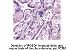 Image no. 2 for anti-Roundabout, Axon Guidance Receptor, Homolog 4 (ROBO4) (AA 200-300), (Internal Region) antibody (ABIN363597) (ROBO4 Antikörper  (Internal Region))
