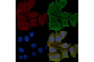 ABIN6257067 and ABIN6275524 staining Hela cells(45 min of heat-shock) by IF/ICC.