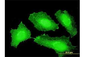 Immunofluorescence of monoclonal antibody to CTNNB1 on HeLa cell. (CTNNB1 Antikörper  (AA 682-781))