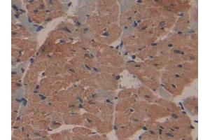 Used in DAB staining on fromalin fixed paraffin- embedded kidney tissue (COL1A1 Antikörper  (AA 1225-1453))