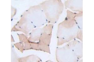Used in DAB staining on fromalin fixed paraffin- embedded Kidney tissue (Myogenin Antikörper  (AA 4-219))