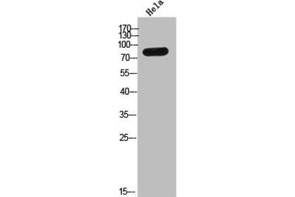 TMC8 Antikörper  (C-Term)