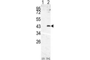 Western Blotting (WB) image for anti-Signal Peptide Peptidase 3 (SPPL3) antibody (ABIN3002611) (SPPL3 Antikörper)