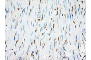 Immunohistochemical staining of paraffin-embedded colon tissue using anti-NME4 mouse monoclonal antibody. (NME4 Antikörper)