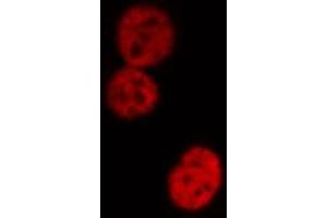 ABIN6274181 staining HeLa cells by IF/ICC. (UBTF Antikörper  (Internal Region))
