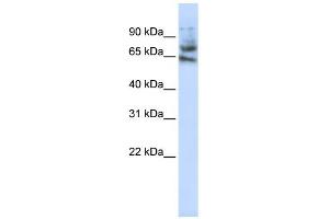 MCTP1 antibody used at 1 ug/ml to detect target protein. (MCTP1 Antikörper  (Middle Region))