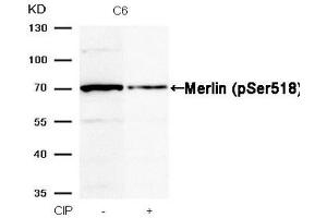 Western blot analysis of extracts from C6 cells, treated with calf intestinal phosphatase (CIP), using Merlin (Phospho-Ser518) Antibody. (Merlin Antikörper  (pSer518))