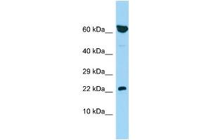 Host: Rabbit Target Name: PBOV1 Sample Type: 721_B Whole Cell lysates Antibody Dilution: 1.