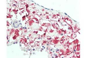 Anti-Osteoglycin / Mimecan antibody IHC staining of human lung, pleura. (OGN Antikörper  (AA 246-276))