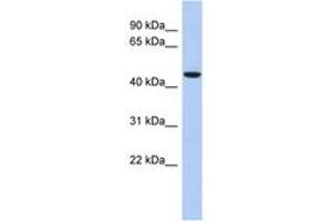 Image no. 1 for anti-Zinc Finger Protein 566 (ZNF566) (AA 143-192) antibody (ABIN6742647) (ZNF566 Antikörper  (AA 143-192))