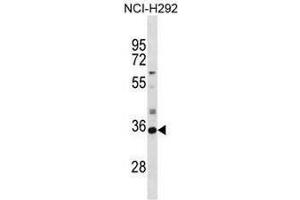SULT2A1 Antibody (N-term) western blot analysis in NCI-H292 cell line lysates (35µg/lane). (SULT2A1 Antikörper  (N-Term))