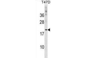 Western Blotting (WB) image for anti-C-Type Lectin Domain Family 4, Member D (CLEC4D) antibody (ABIN2999516) (CLEC4D Antikörper)
