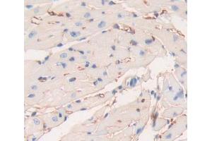 DAB staining on fromalin fixed paraffin- embedded heart tissue) (PLCE1 Antikörper  (AA 1-250))