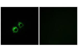 Immunofluorescence analysis of MCF-7 cells, using MRPS21 antibody. (MRPS21 Antikörper  (Internal Region))