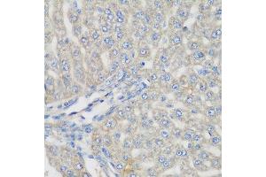 Immunohistochemistry of paraffin-embedded rat liver using METTL7A antibody at dilution of 1:200 (40x lens).