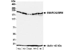 Western Blotting (WB) image for anti-SWI/SNF Related, Matrix Associated, Actin Dependent Regulator of Chromatin, Subfamily A, Member 2 (SMARCA2) (AA 1325-1375) antibody (ABIN7795708)