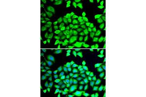 Immunofluorescence analysis of HeLa cells using CLCN7 antibody (ABIN6294018). (CLCN7 Antikörper)