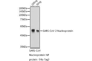 Western blot analysis of Recombinant Nucleoprotein of Coronavirus SARS-CoV-2,using SARS-CoV-2 Nucleoprotein antibody (ABIN7269053) at 1:1000 dilution. (SARS-CoV-2 Envelope Antikörper)