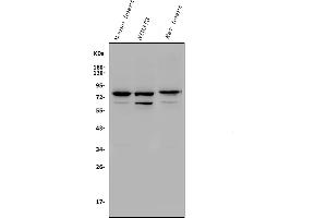 Western blot analysis of Rad17 using anti-Rad17 antibody (ABIN7599188).