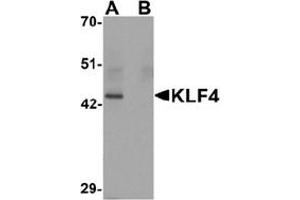 Image no. 1 for anti-Kruppel-Like Factor 4 (Gut) (KLF4) (C-Term) antibody (ABIN1449393) (KLF4 Antikörper  (C-Term))