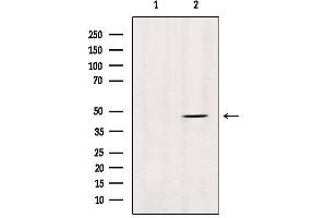 Western blot analysis of extracts from HepG2, using MMP28 Antibody.